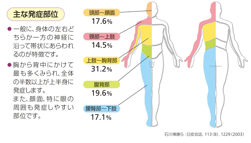 主な発症部位