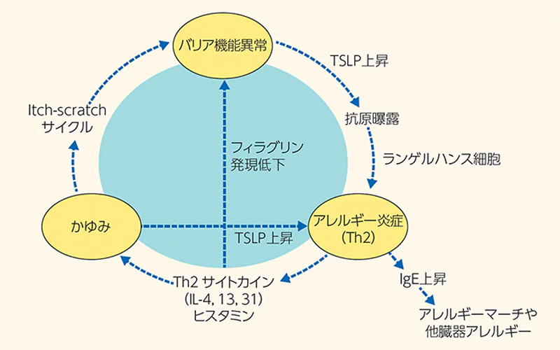 （図１）アトピー性皮膚炎の病態 itch-scratch-cycle と 三位一体 理論
