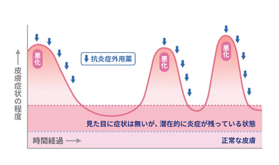 リアクティブ療法