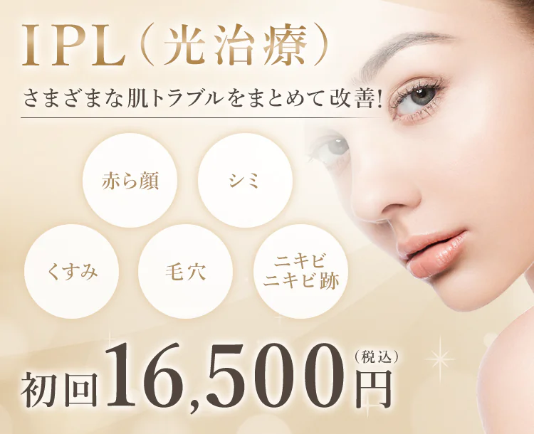 IPL（光治療）